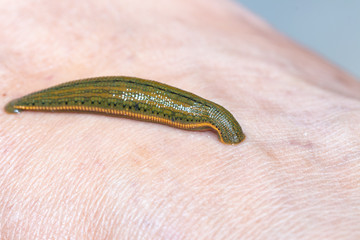 Aquatic Leech sucking blood on skin,Leeches were used in medicine from ancient