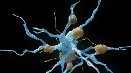 3d rendered medical illustration of nerve cells suffering from alzheimer disease