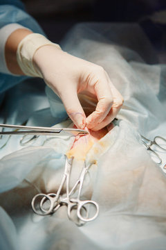Crop surgeon suturing patient