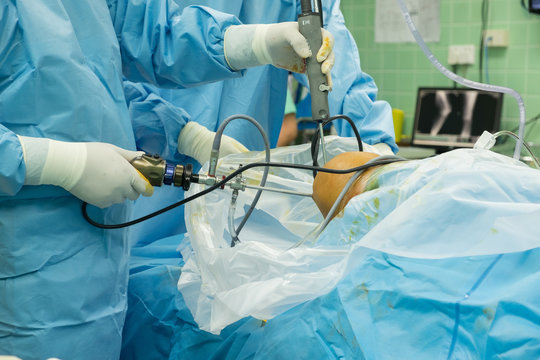 knee arthroscope surgery