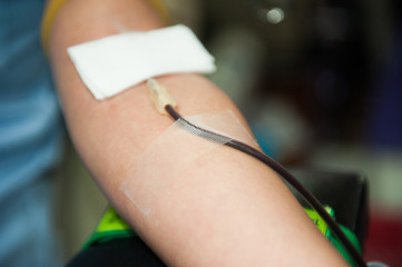 The blood donation