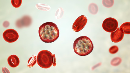 Red blood cells infected with malaria parasite, 3D illustration showing Plasmodium parasites inside red blood cells in the stage of schizont