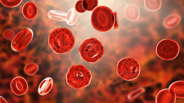 Blood smear in malaria patient. Plasmodium vivax inside red blood cell in the stage of ring-form trophozoite, the causative agent of malaria disease, 3D illustration