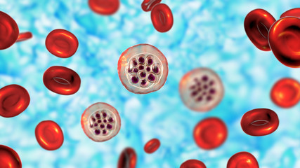 Red blood cells infected with malaria parasite Plasmodium vivax, schizont stage, 3D illustration