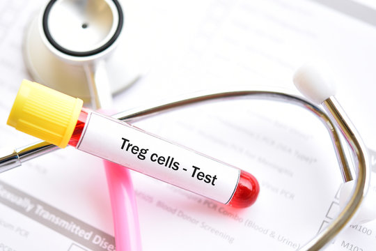 Blood Sample Tube For Regulatory T Cells Or Treg Cells Test