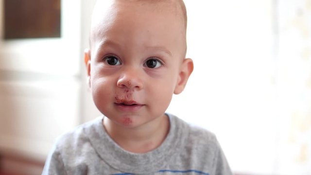 Slow motion, Baby boy with scratch of lips, nose and chin looks on his parents. Real injury after falling out of perambulator. Video may be used for family or domestic violence