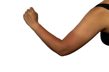 日焼け跡がはっきり残る日本人女性の左腕