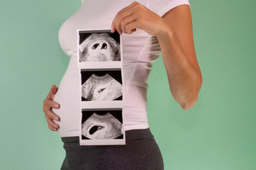 The girl is holding a snapshot of an ultrasound twin in the fourth week of pregnancy. First...
