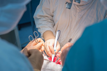 a surgeon with assistants, in a sterile operating room, is operated on internal organs.