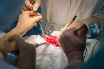 a surgeon with assistants, in a sterile operating room, is operated on internal organs.