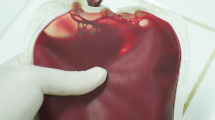 Red blood on blood bag in laboratory.