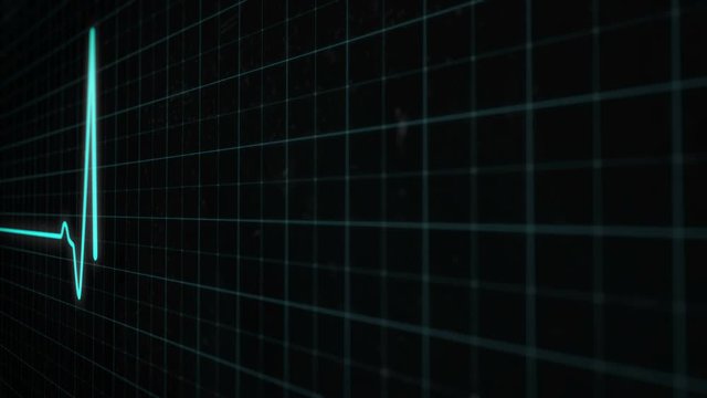 Medical ECG EKG monitor with heartbeat cyan line in close-up, seamlessly loop footage. Cardiac impulse sequence on medical grid screen