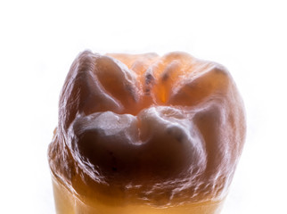 extracted whisdom tooth with natural anatomy
