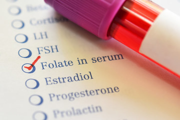 Obraz premium Blood sample tube with laboratory requisition form for folate test