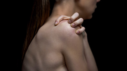 Female suffering anorexia scratching shoulder, psychological problem, disorder - obrazy, fototapety, plakaty