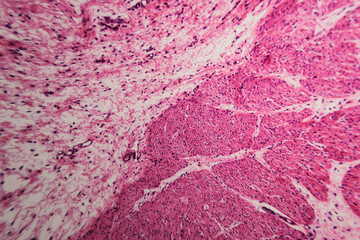 Cell microscopic- pyloric division stomach