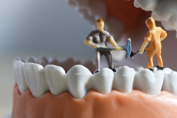 Miniature people or small figure worker cleaning tooth model as medical and healthcare concept. Cleaning team work on teeth model for dental or dentist idea