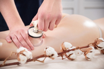 Anti-cellulite thigh massage using vacuum jars cans banks. Man putting physiological therapist's vacuum can on female thigh in spa salon