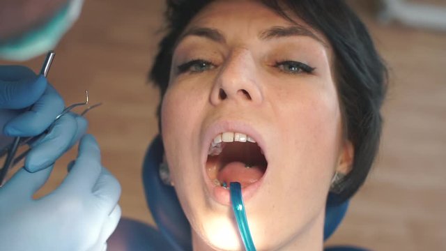 doctor with a tool checks a tooth for a girl with an open mouth