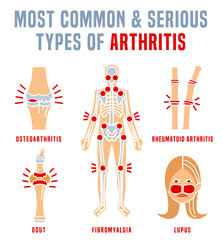 Arthritis types infographic