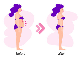 Weight loss. Woman with a obesity. Excess weight problem, fat, health care, unhealthy lifestyle concept design.