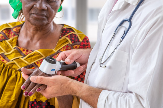 Elderly Woman Getting Check-up At Dermatologist.,usig Magnifying Glass To See Mole