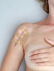 Close up of female shoulder with a scar after install a metal plate bone fracture surgically. Wound is sealed with a medical plaster.