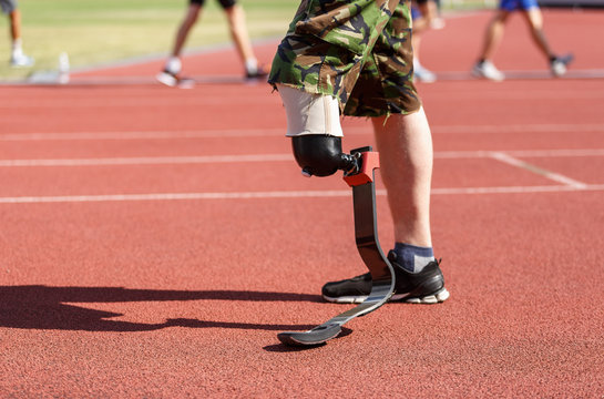 Ukrainian amputee veteran running with a prostethic leg. Paraolympic athlete with amputated limb training outdoors.