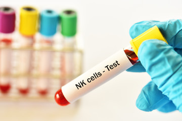 Blood sample tube for NK cells test