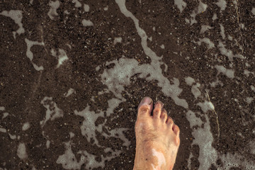 Man's legs with vitiligo on the sand beach