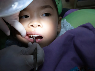 The dentist treats the child. Keeping baby teeth. ( Dental Filling )