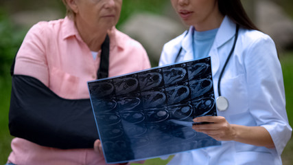 Female physician showing x-ray image to mature female patient wearing arm sling