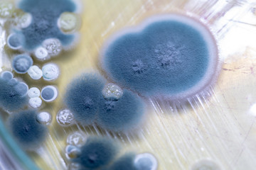 Mold Beautiful, Colony of Characteristics of Fungus (Mold) in culture medium plate from laboratory microbiology.