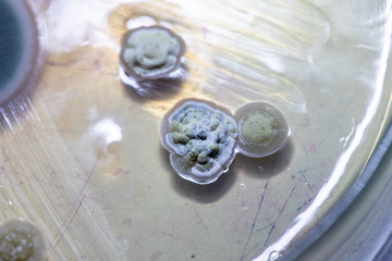 Mold Beautiful, Colony of Characteristics of Fungus (Mold) in culture medium plate from laboratory microbiology.