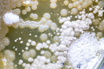 Mold Beautiful, Colony of Characteristics of Fungus (Mold) in culture medium plate from laboratory...