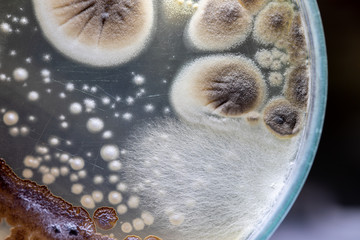 Mold Beautiful, Colony of Characteristics of Fungus (Mold) in culture medium plate from laboratory microbiology.
