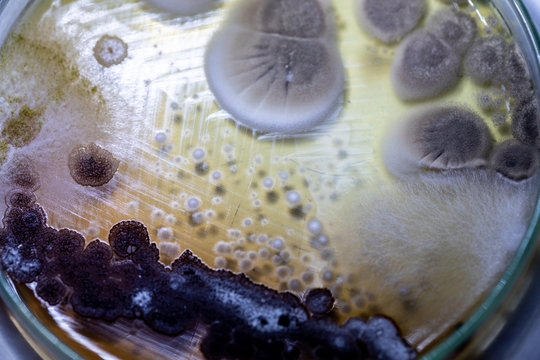 Mold Beautiful, Colony of Characteristics of Fungus (Mold) in culture medium plate from laboratory microbiology.