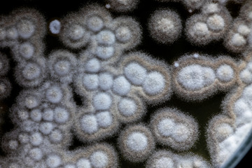 Mold Beautiful, Colony of Characteristics of Fungus (Mold) in culture medium plate from laboratory microbiology.