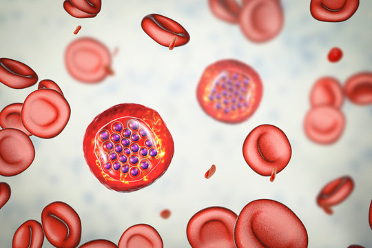 The malaria-infected red blood cells. 3D illustration showing malaria parasite Plasmodium falciparum in schizont stage inside red blood cells, the causative agent of tropical malaria