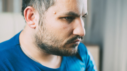 The tumor on the face of men near his temple , Lipoma Wen or zit, ugly acne, dermatology and ugliness