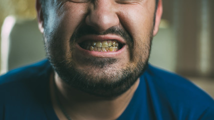 men are horrible, sick, and dirty teeth, yellow is not beautiful, bad breath