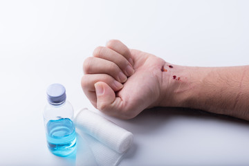 Man hand has a wound and bleeding on his wrist isolated on white background.First aid concept