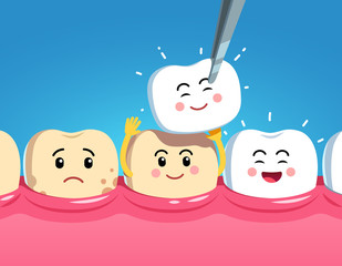 Funny cartoon teeth characters on gum and veneer