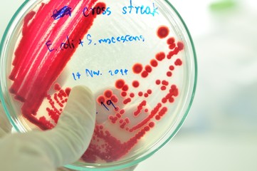 red colony of bacteria in mircobiology laboratory