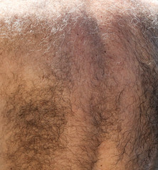 Fototapeta premium Hair on the back of a man