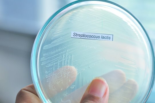 colony of bacteria in microbiology laboratory