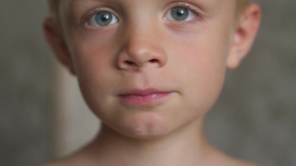 Close-up face of a little boy with a scratched nose. The child fell and scratched the skin under the nose. A wound on the face of a little boy.