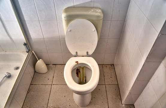 Toilet stained with feces and urine.