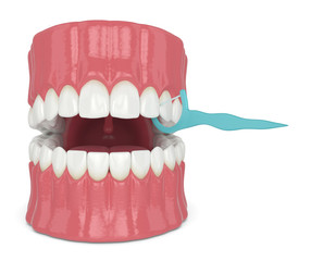 3d render of jaw with dental floss toothpick