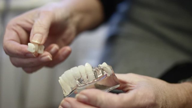 Close up of model as dentist uses it to explain a dental bridge